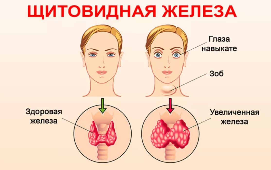 Вопрос-ответ: эндокринолог - институт здоровья в люберцах