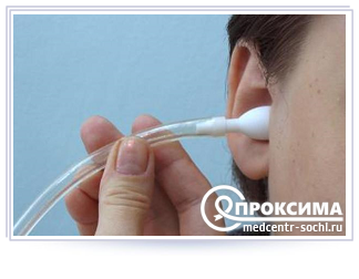 Экссудативный средний отит у детей и взрослых