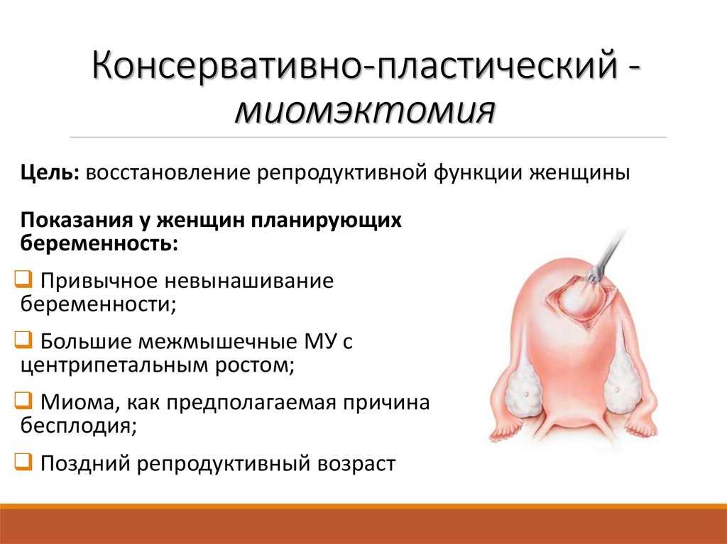 Половая жизнь после удаления матки