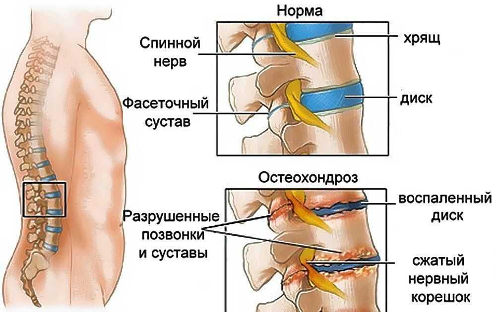 Найз и миг: сравнение препаратов и что лучше | в чем разница