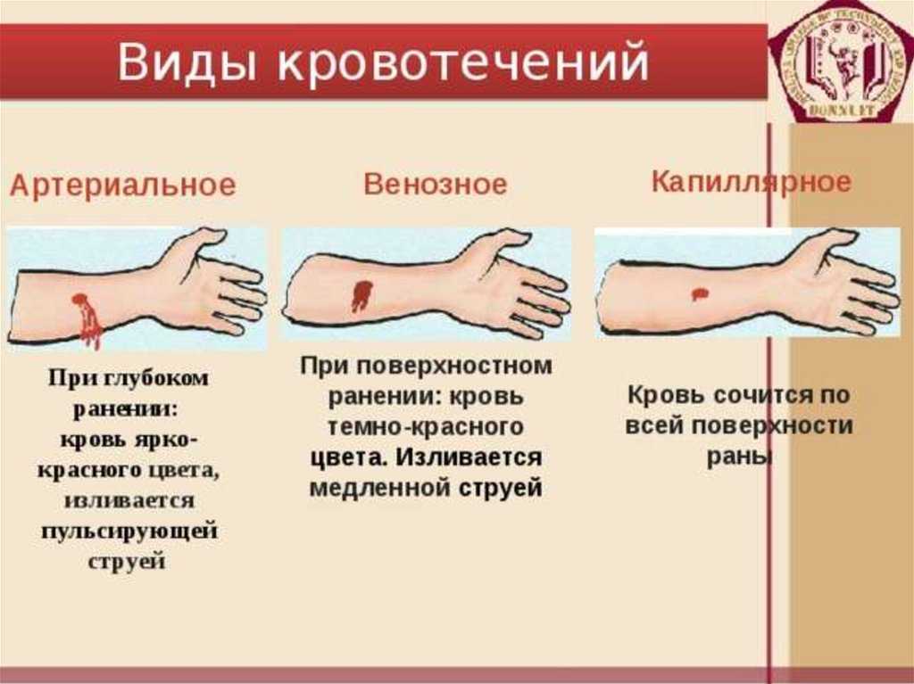 Cудебно-медицинская  оценка  особенностей резаных  ран  в  зависимости  от  конструкции лезвия  и  условий  травмирования