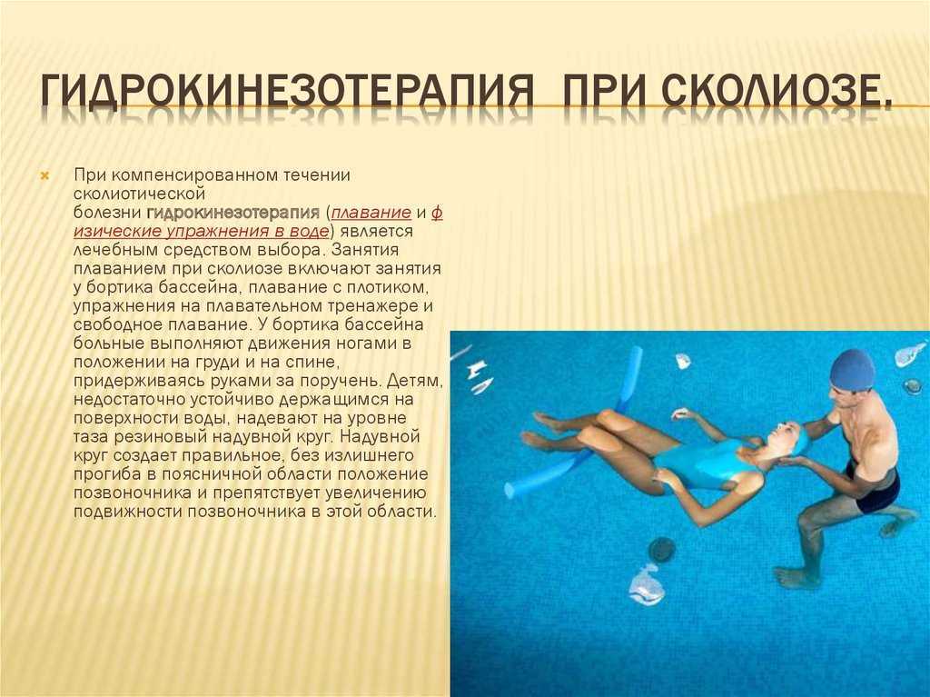 Сколиоз 1 и 2 степени. реабилитация