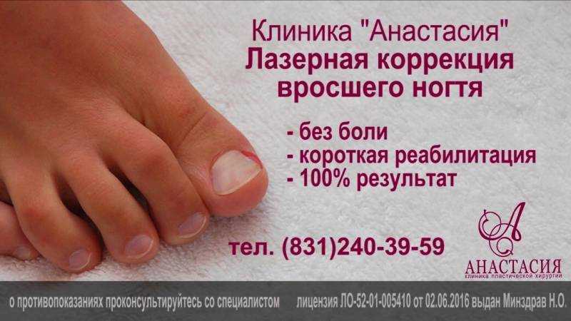 Вросший ноготь