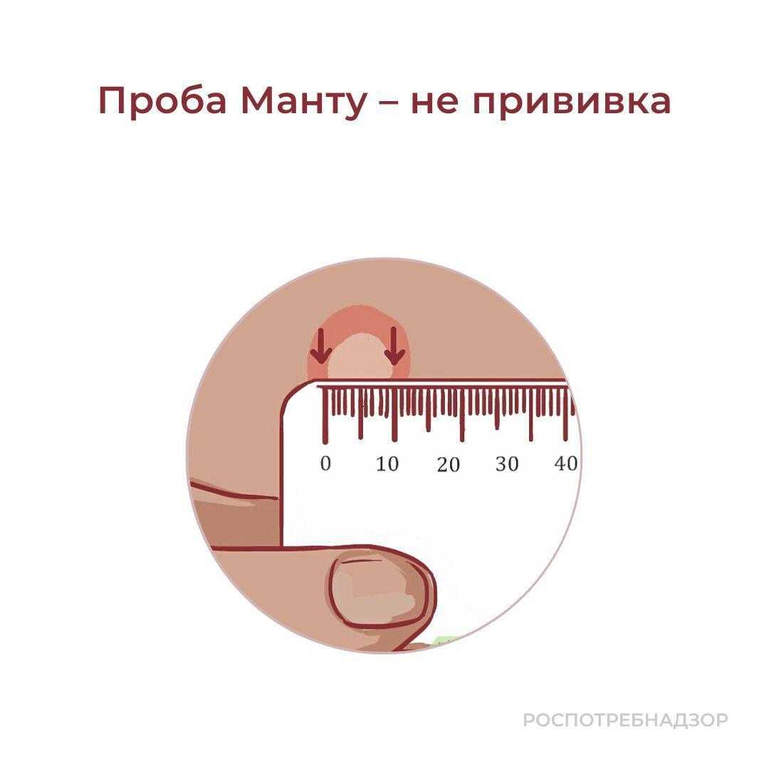 На какой день проверяют манту у ребенка