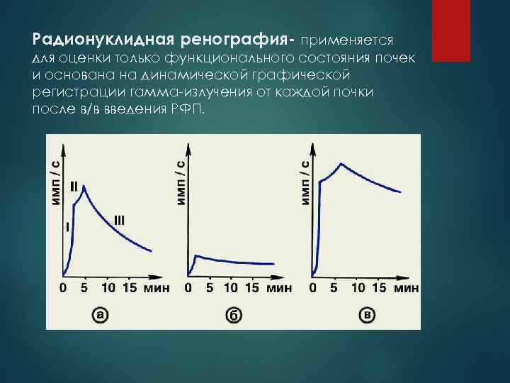 Радиоизотопная ренография почек: суть диагностики