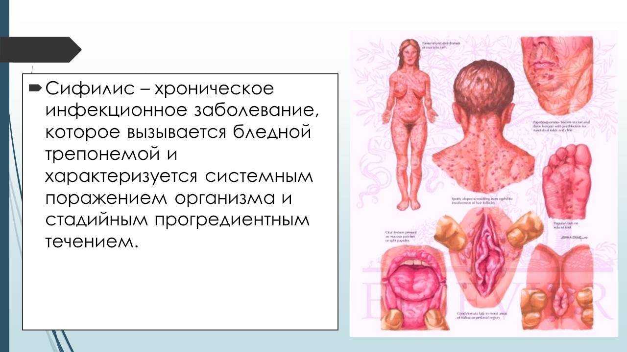 Герпес на губах —  витагерпавак