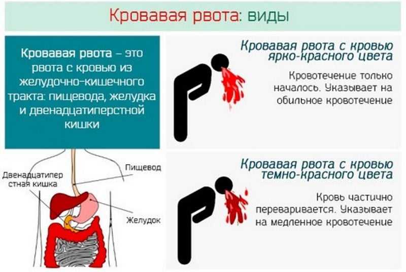 Новинет (novynette): описание, рецепт, инструкция