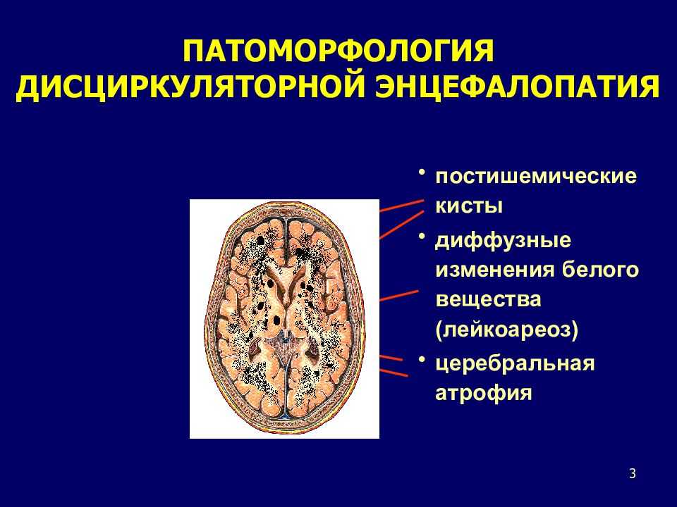 Аноксическое поражение головного мозга