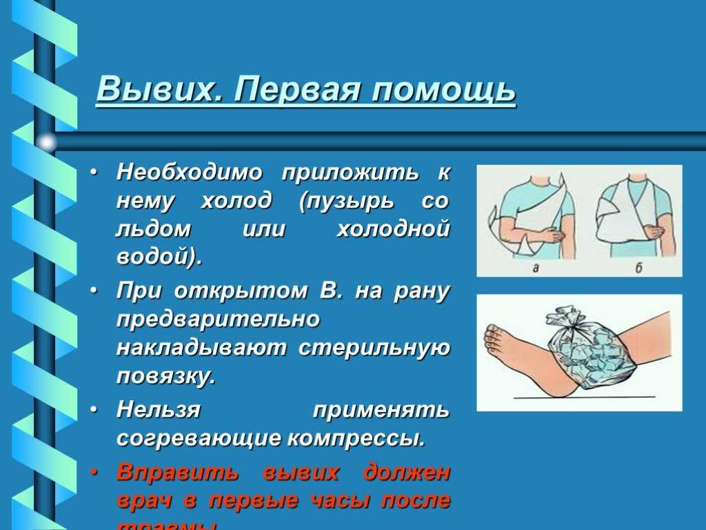 Лечение вывихов, растяжений, разрывов связок