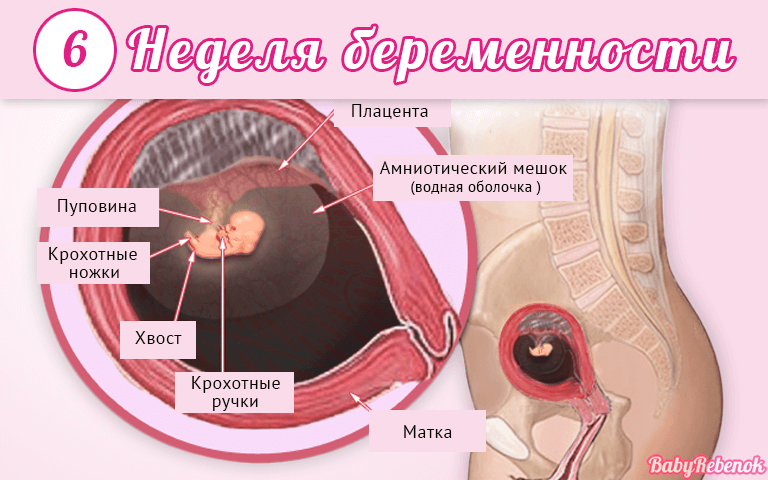 6 неделя беременности: размер плода, ощущения и фото узи