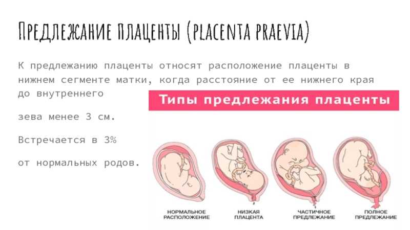 Формирование плаценты при беременности, норма и патология развития