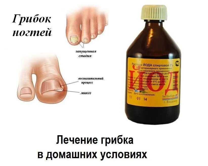 Диета при грибке кожи