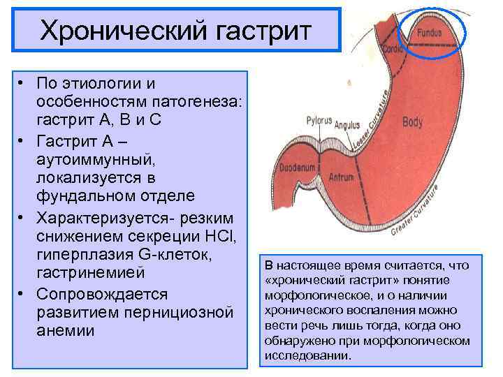 Гиперплазия желудка это рак или нет