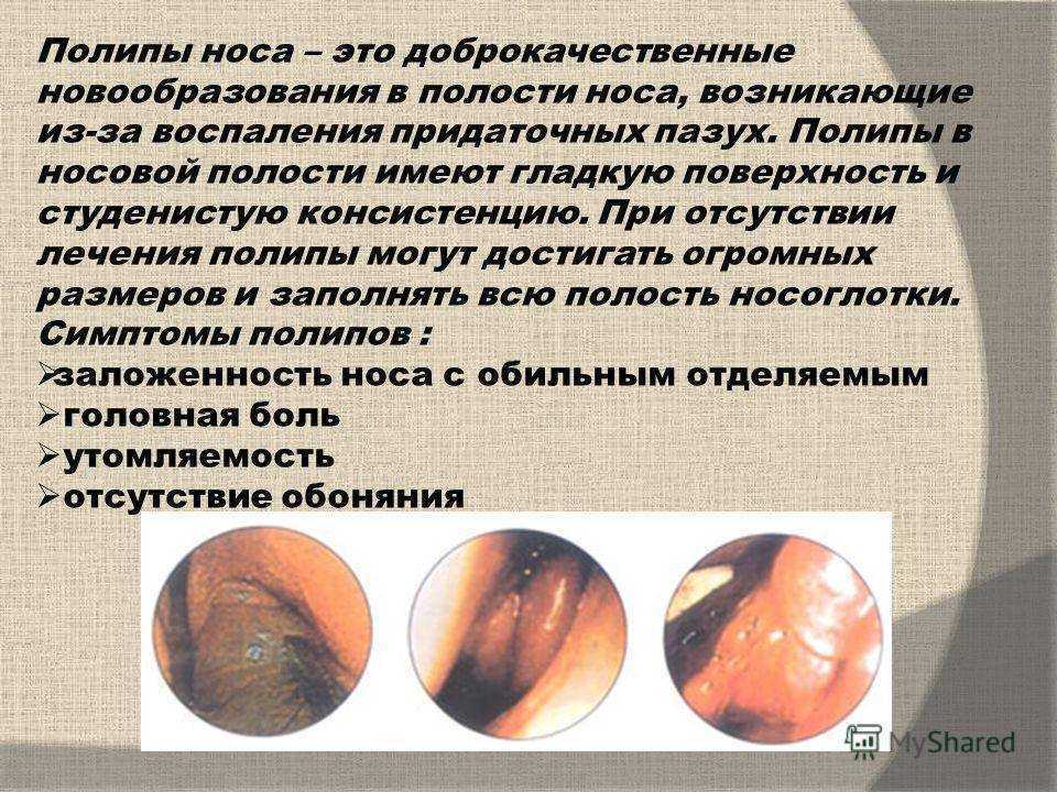 Препараты для восстановления слизистой оболочки носа