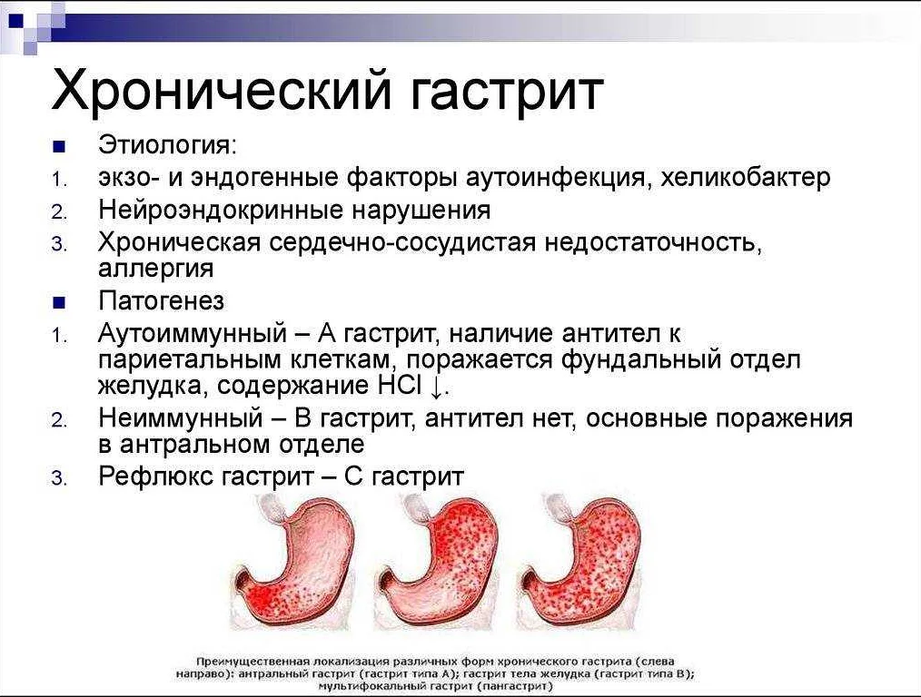 Головокружение при гастрите: причины и виды головных болей