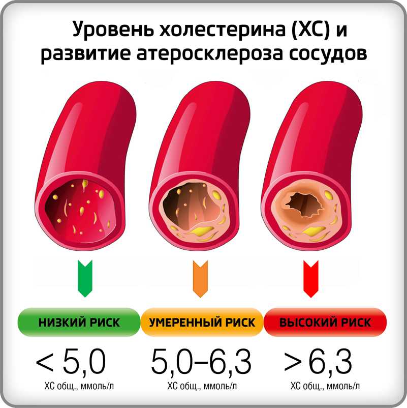 Алкоголь и холестерин: содержится ли и как влияет?