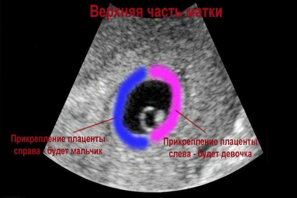 На каком сроке можно определить пол ребенка по узи точно? советы родителям | семья и мама