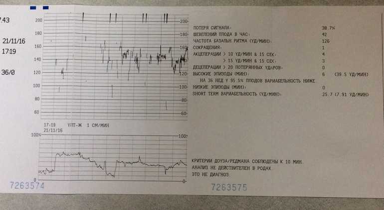 Можно ли проводить кт при беременности на ранних сроках и есть ли риск облучения плода