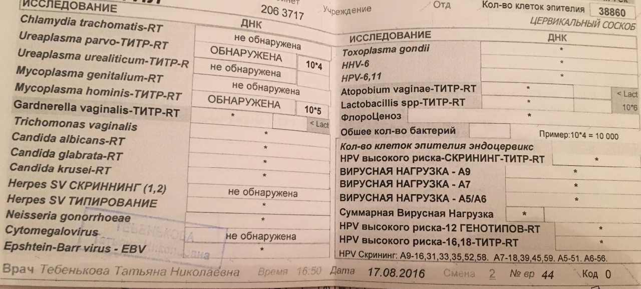 Анализ на уреаплазму у женщин: как берут, расшифровка