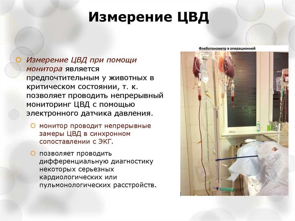 Измерение венозного давления: методы, как измерить венозное давление - medicclub