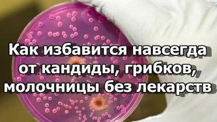 Хроническая молочница