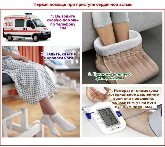 Сердечная астма: причины развития, симптомы у взрослых, диагностика и лечение приступов