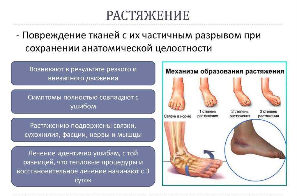Ушиб запястья: симптомы, лечение, диагностика, профилактика