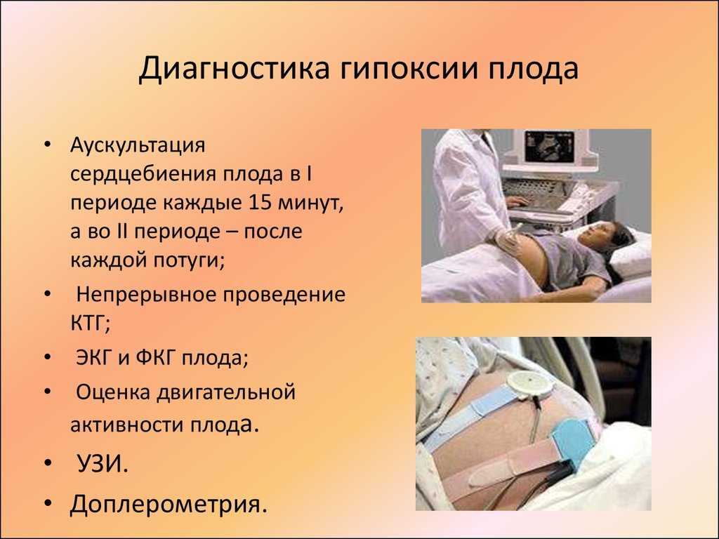 Гипоксия плода. симптомы, признаки, причины, лечение и последствия внутриутробной гипоксии плода.