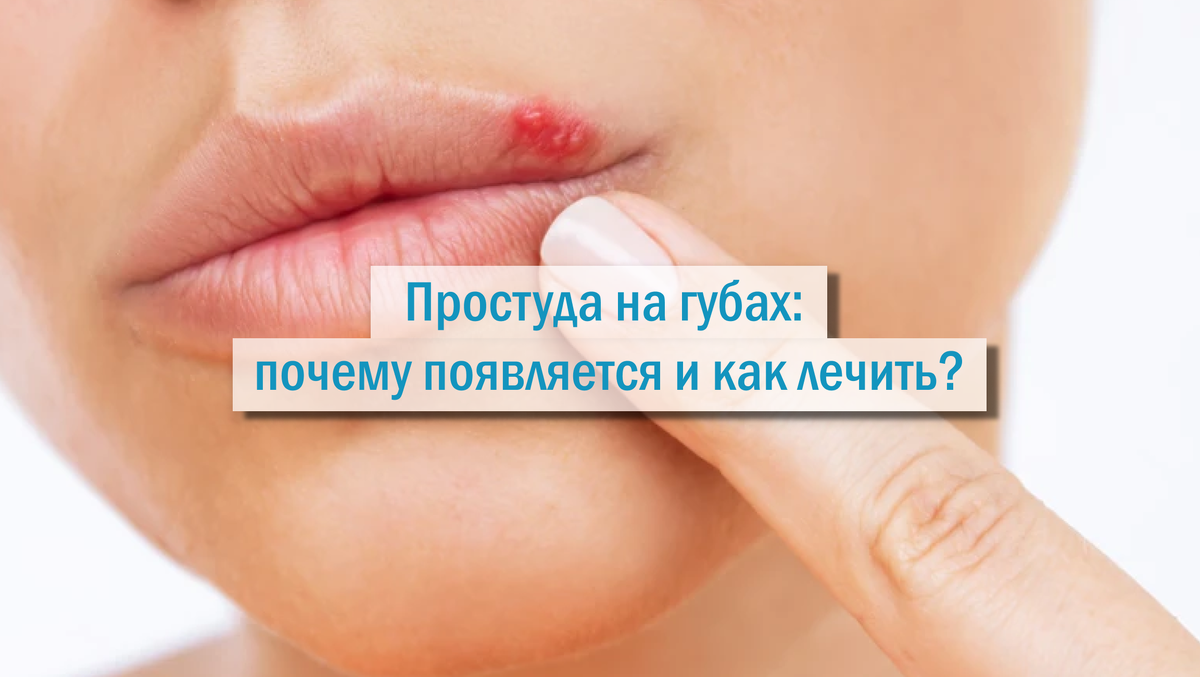 Сколько дней заразен герпес на губах для окружающих?