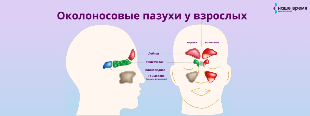 Можно ли гулять при гайморите (синусите) осенью?