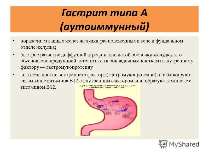 Что такое эритематозная гастропатия, её симптомы и лечение