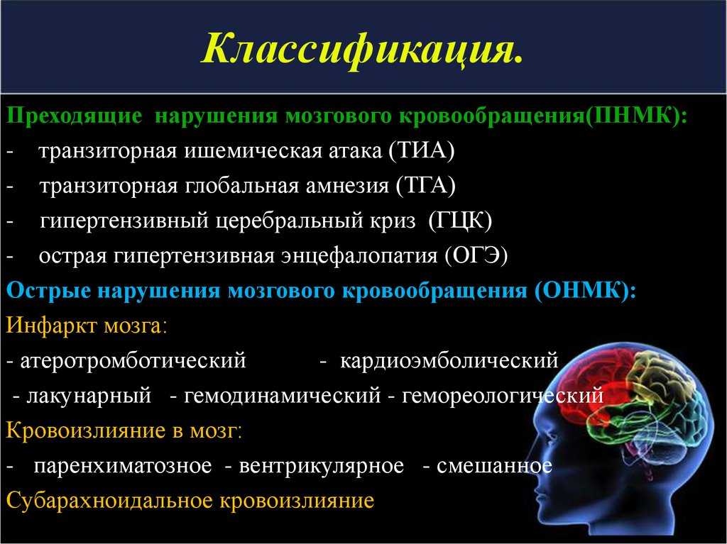 Инсульт