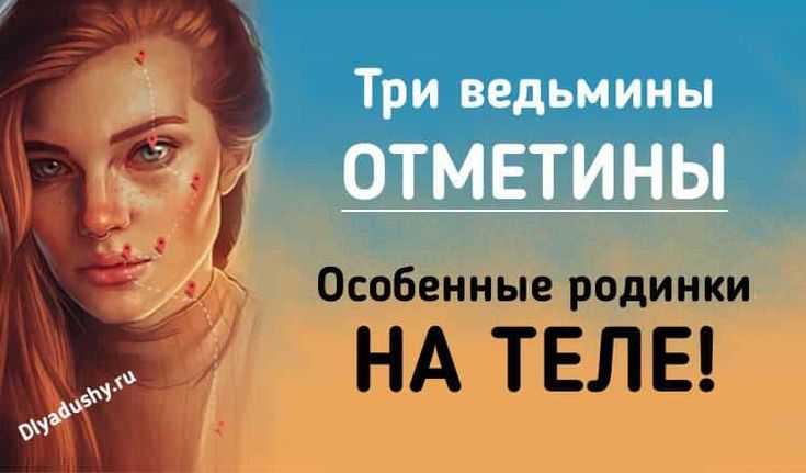 Родинки на теле: три ведьмины отметины значение у женщин и мужчин