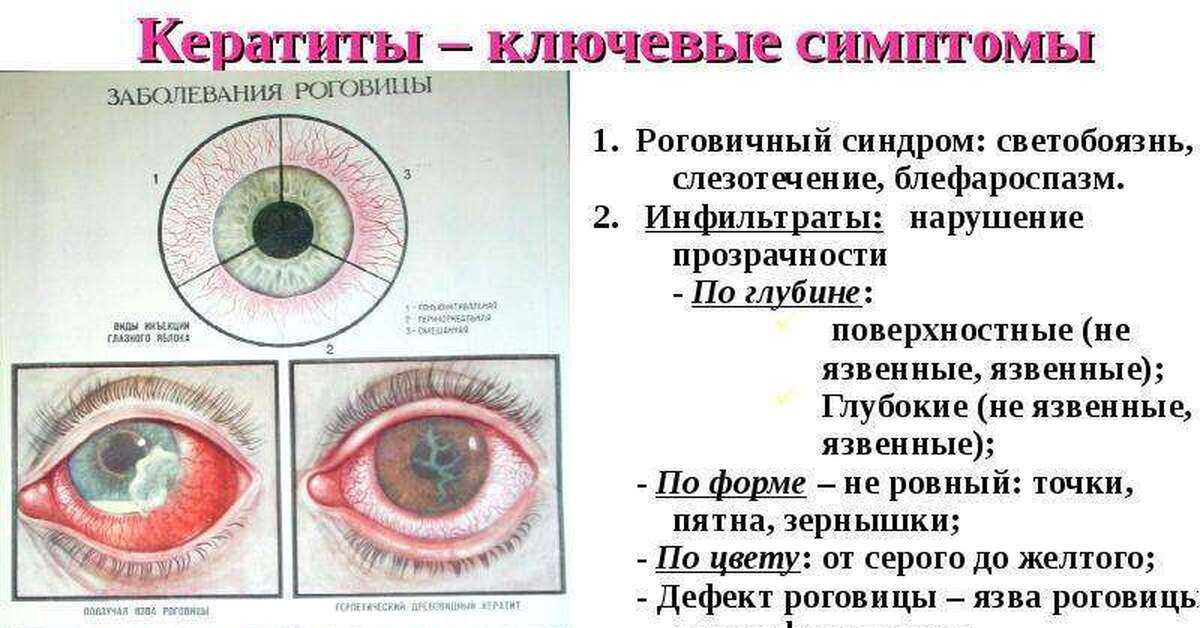 Офтальмоферон — фирн м