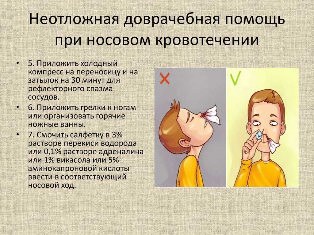 Почему у ребенка идет кровь из носа: причины, лечение