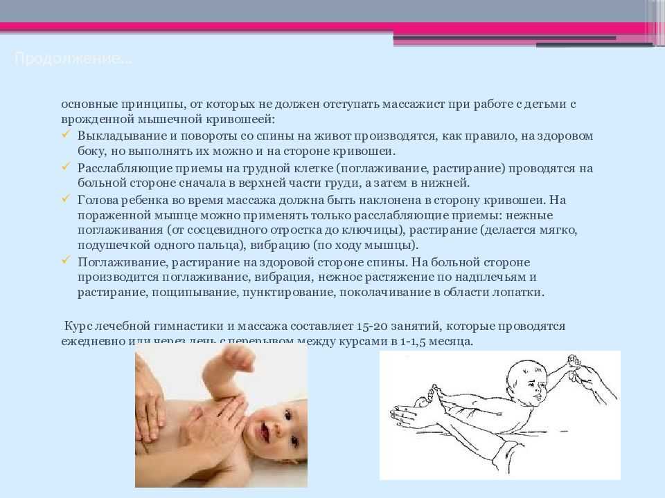 Как распознать кривошею у новорожденного ребенка?