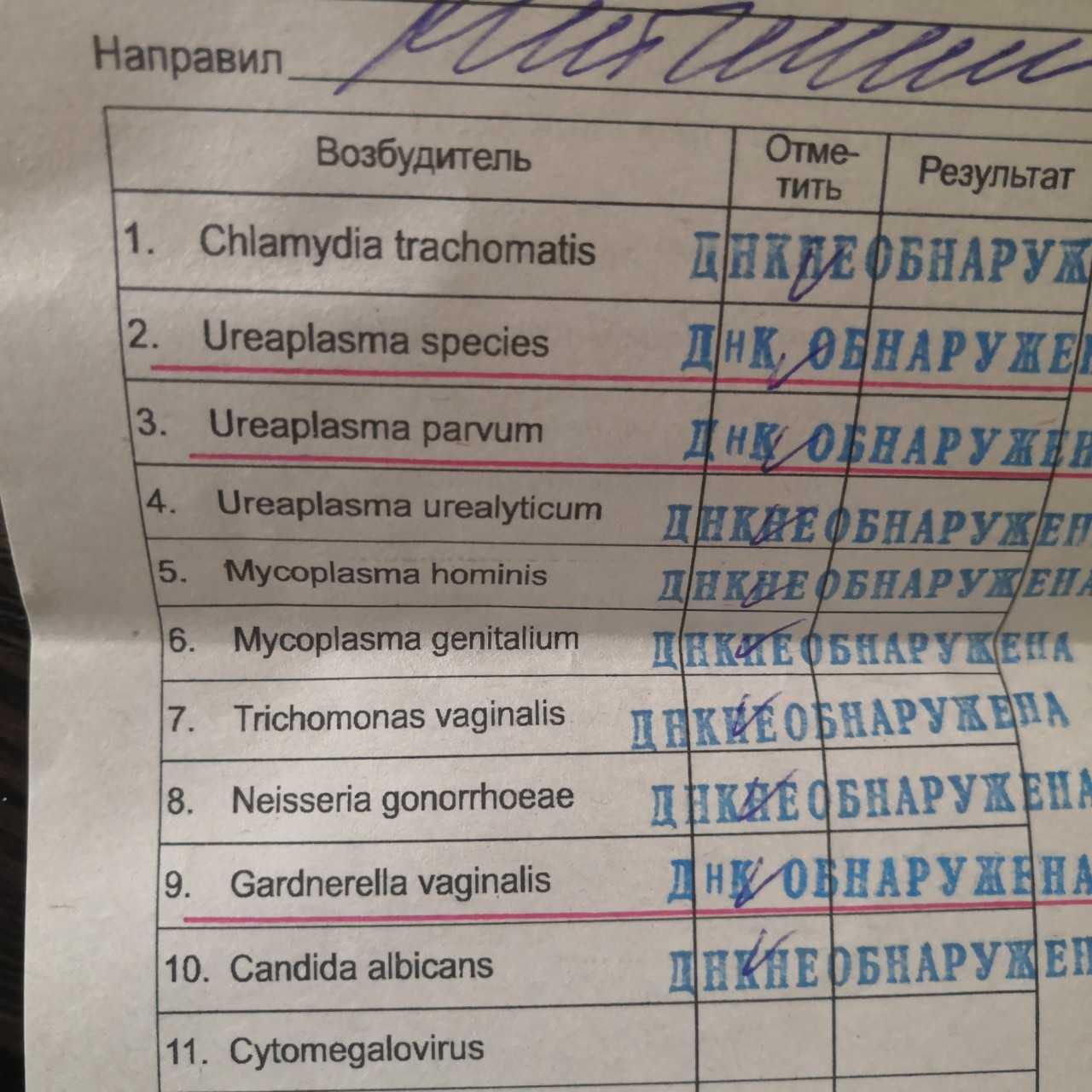 Как заражаются гарднереллезом?