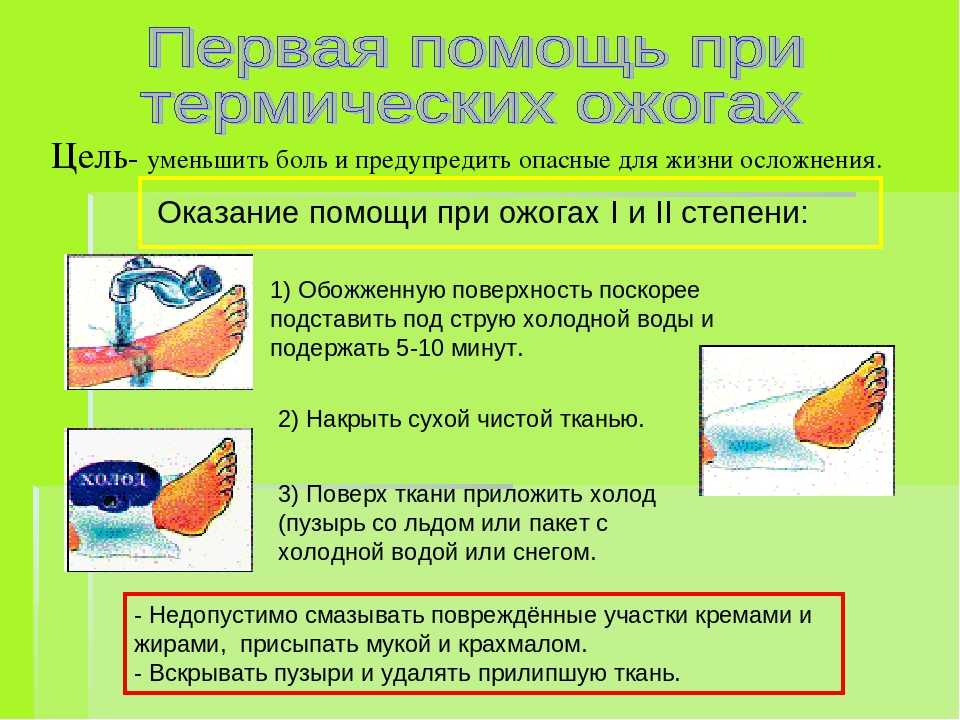 Лучшие местные средства для лечения ожоговых ран