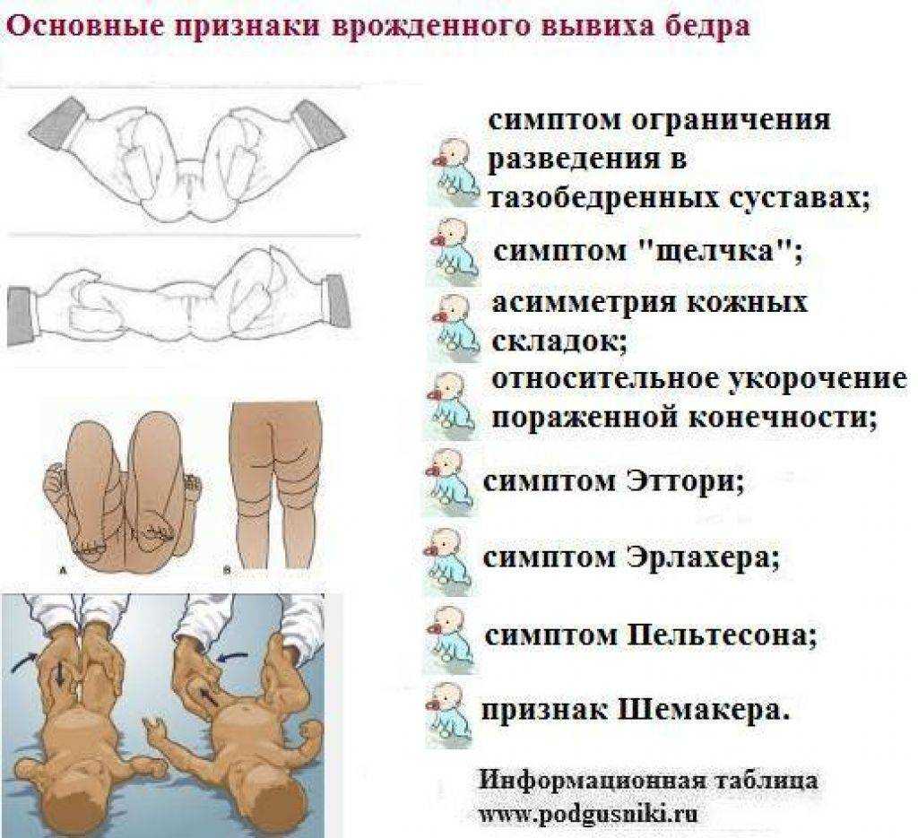 Дисплазия тазобедренных суставов у детей от а до я: почему возникает, как выявляется, проверенные способы лечения