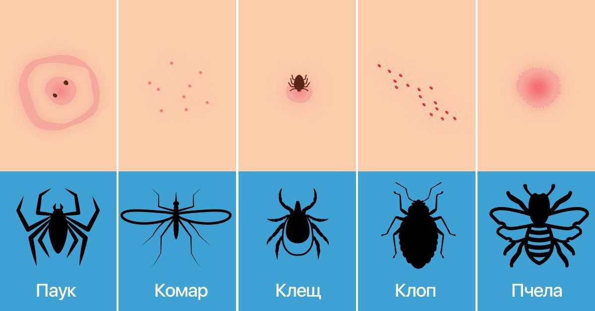 Блохи покусали ребенка, что делать, чем мазать, как лечить