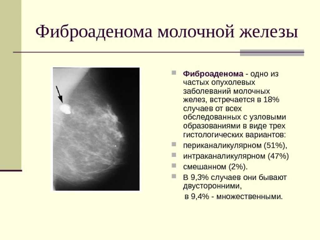 Липома - диагностика, методы лечения. онкология