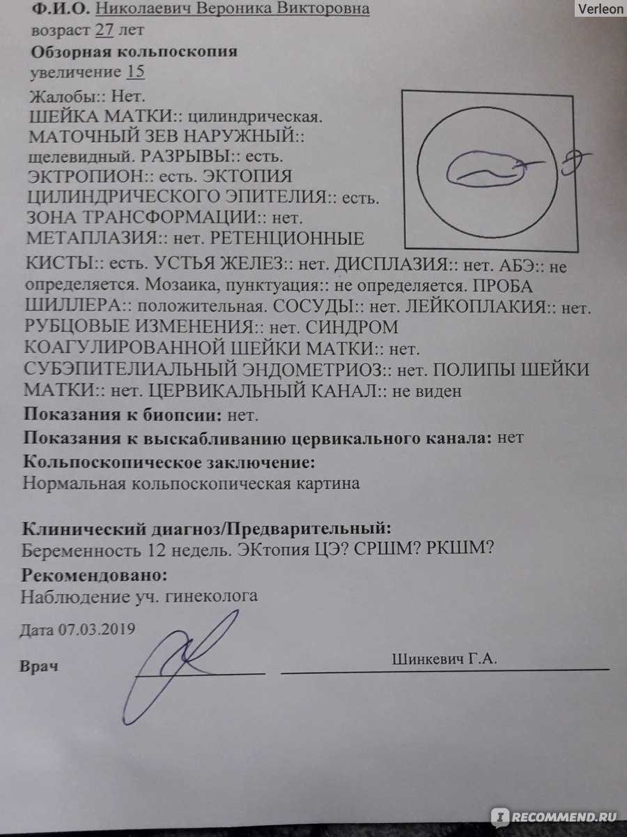 Кольпоскопия – европейский метод обследования