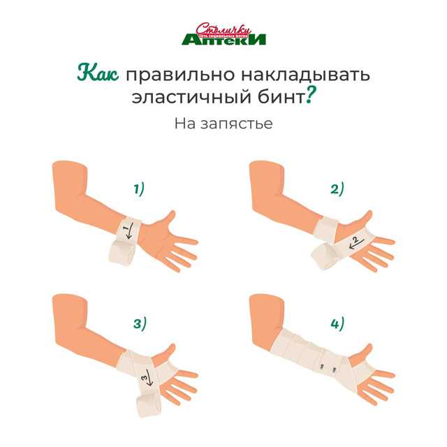 Эластичный бинт при варикозном расширении вен, как бинтовать ноги при варикозе