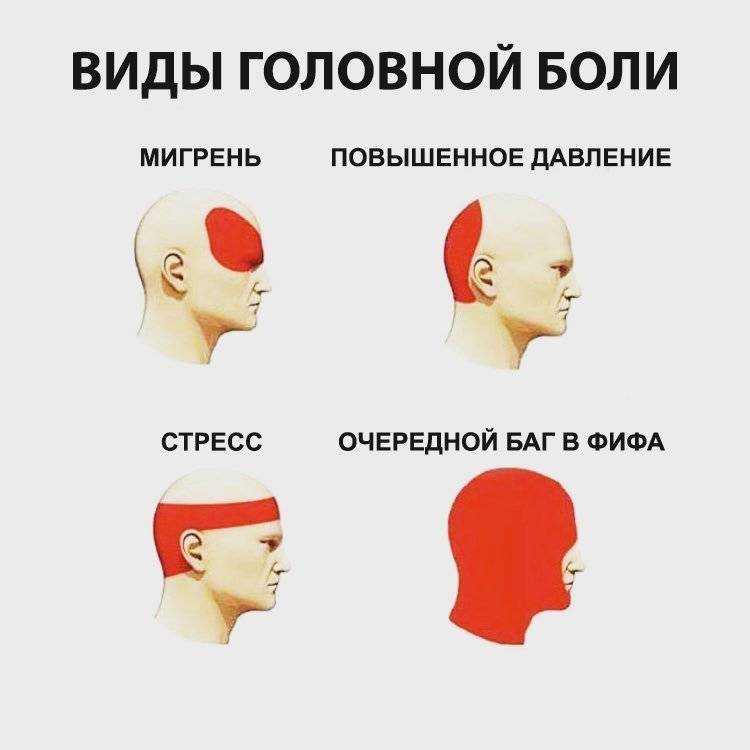 Прострелы в голове – лечение стреляющей боли, причины