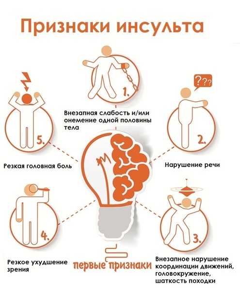 Симптомы инсульта в зависимости от локализации поражения