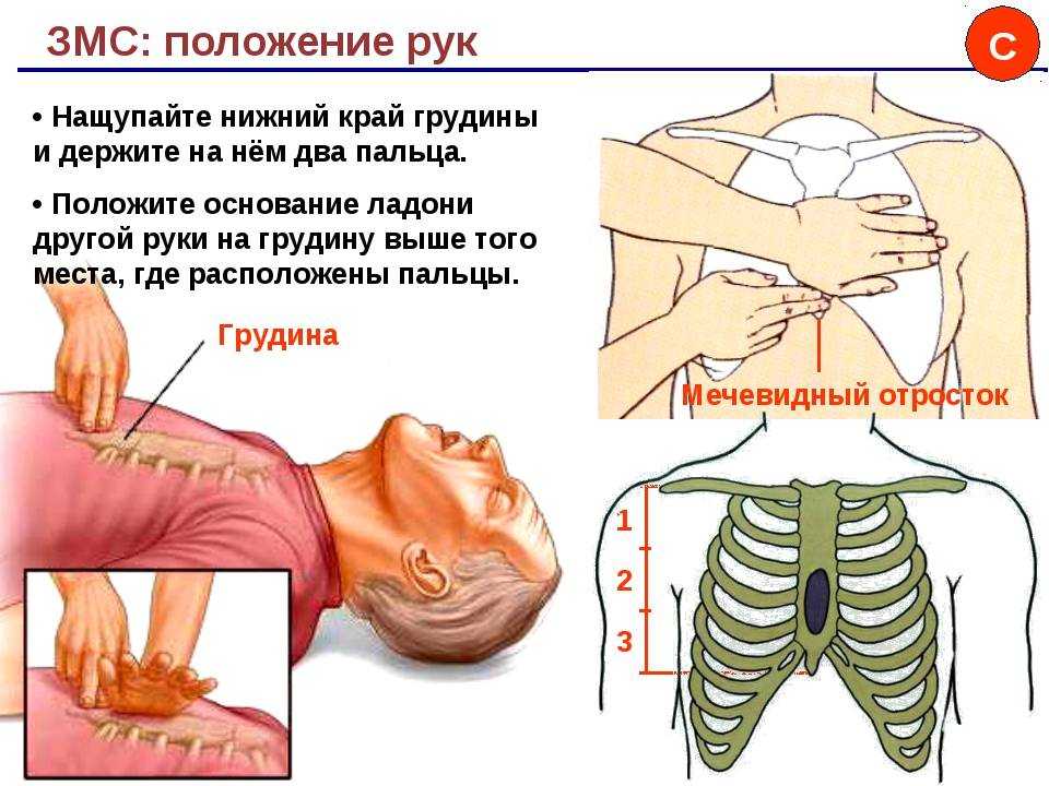 Грыжи пищеводного отверстия диафрагмы
