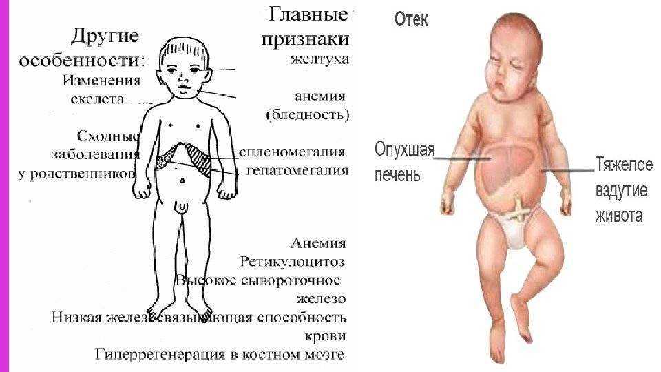 Твердый живот у новорожденного: что делать?