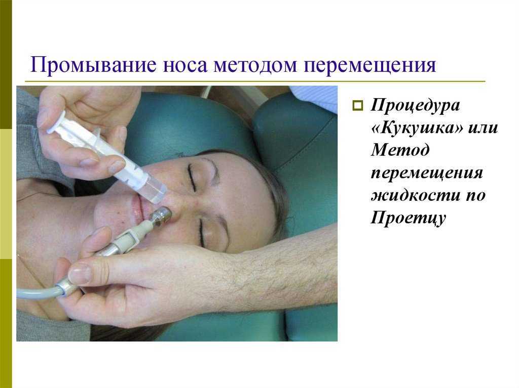 Промывание околоносовых пазух и носа методом вакуумного перемещения у оториноларинголога: необходимая подготовка, особенности процедуры и методика проведения | услуги клиники «проксима» (г. сочи)