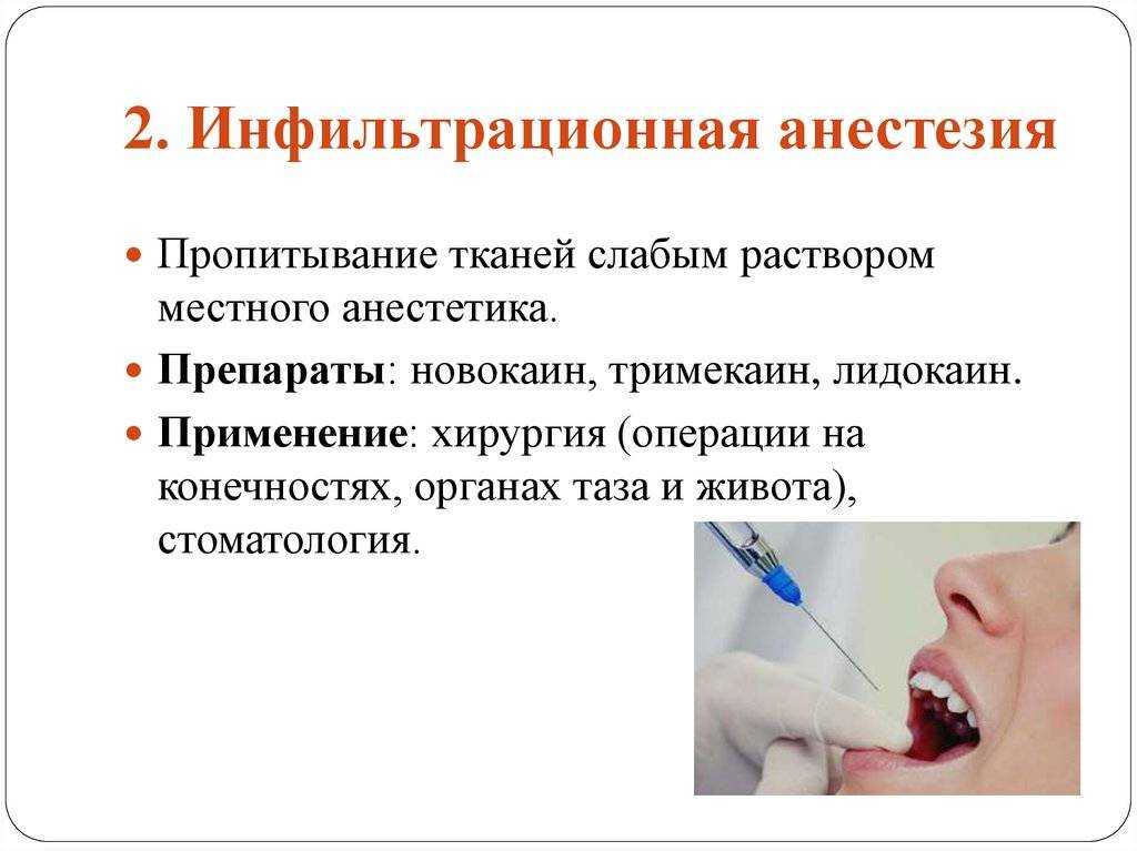 Инфильтрационная анестезия у оториноларинголога: необходимая подготовка, особенности процедуры и методика проведения | услуги клиники «проксима» (г. сочи)