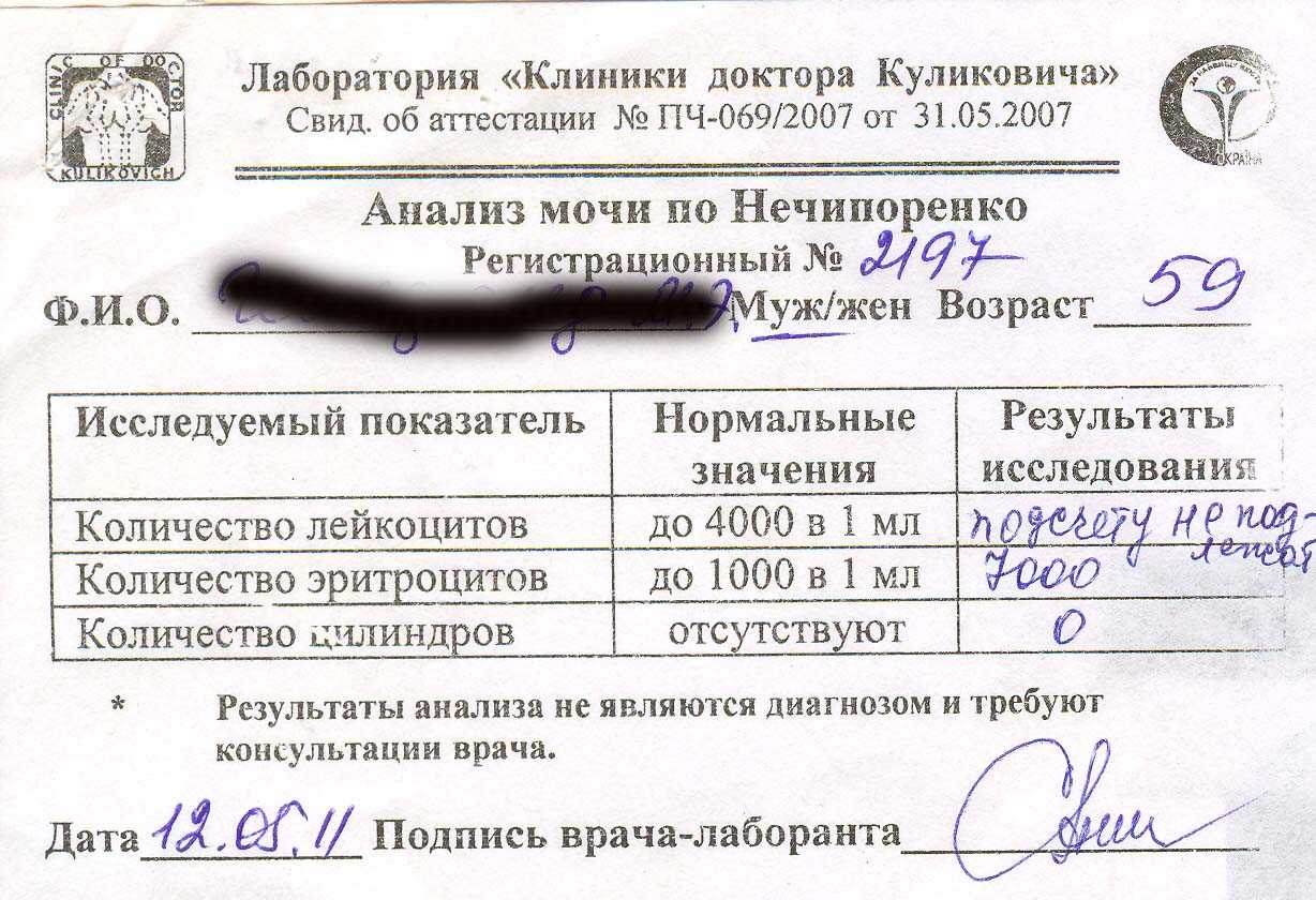 Симптом пастернацкого